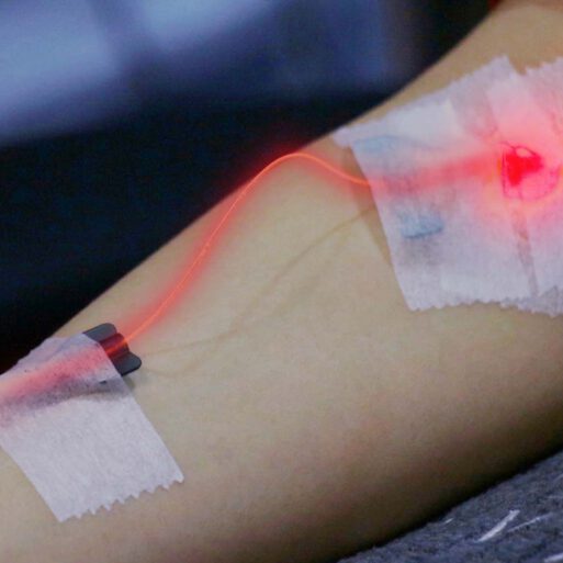 medical laser therapy