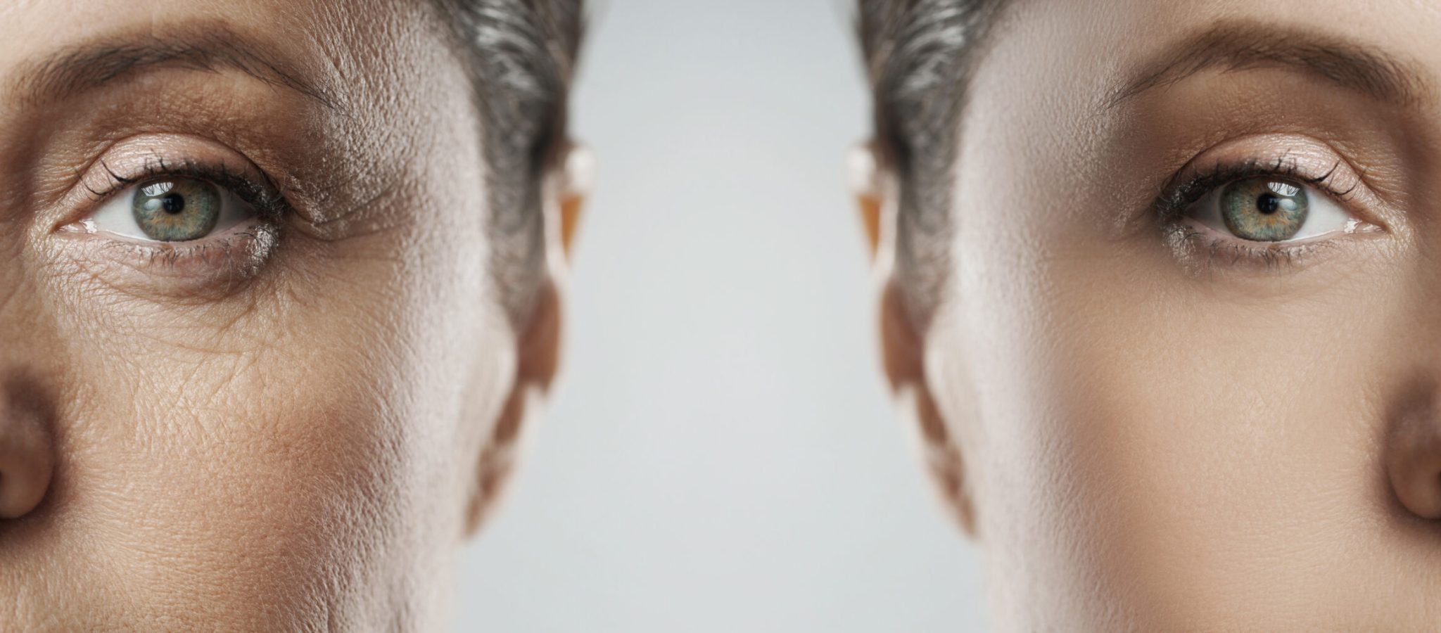 Comparison,Of,Female,Face,After,Incredible,Rejuvenation,Process,Or,Heavy Comparison,Of,Female,Face,After,Incredible,Rejuvenation,Process,Or,Heavy
