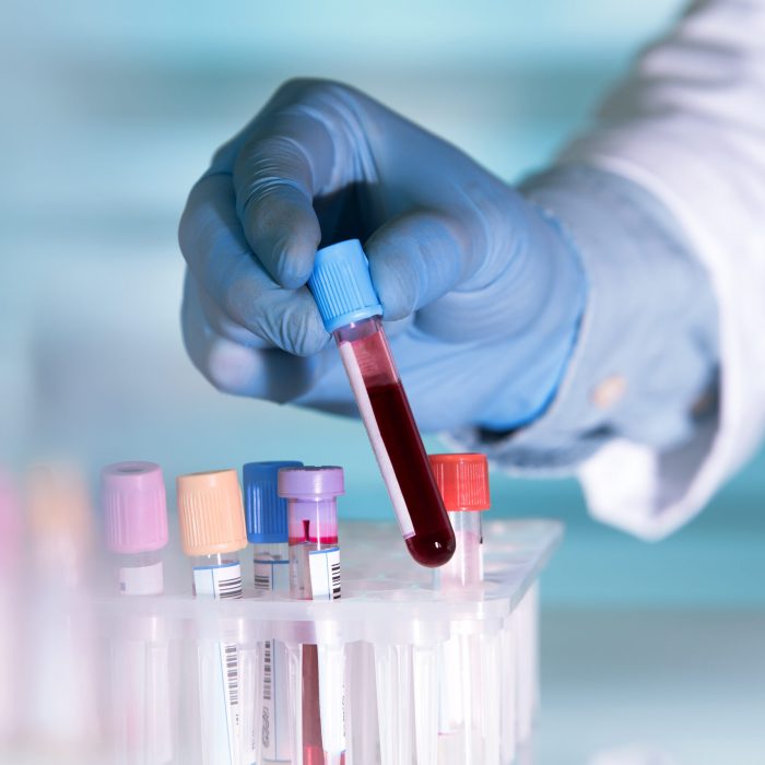 Hands,Of,A,Lab,Technician,With,A,Tube,Of,Blood
